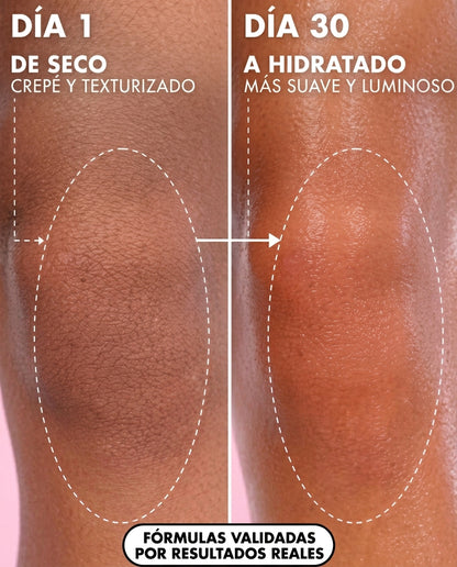Piel Despigmentada, Tono Uniforme En Semanas 1+1 Gratis ¡SOLO HOY!