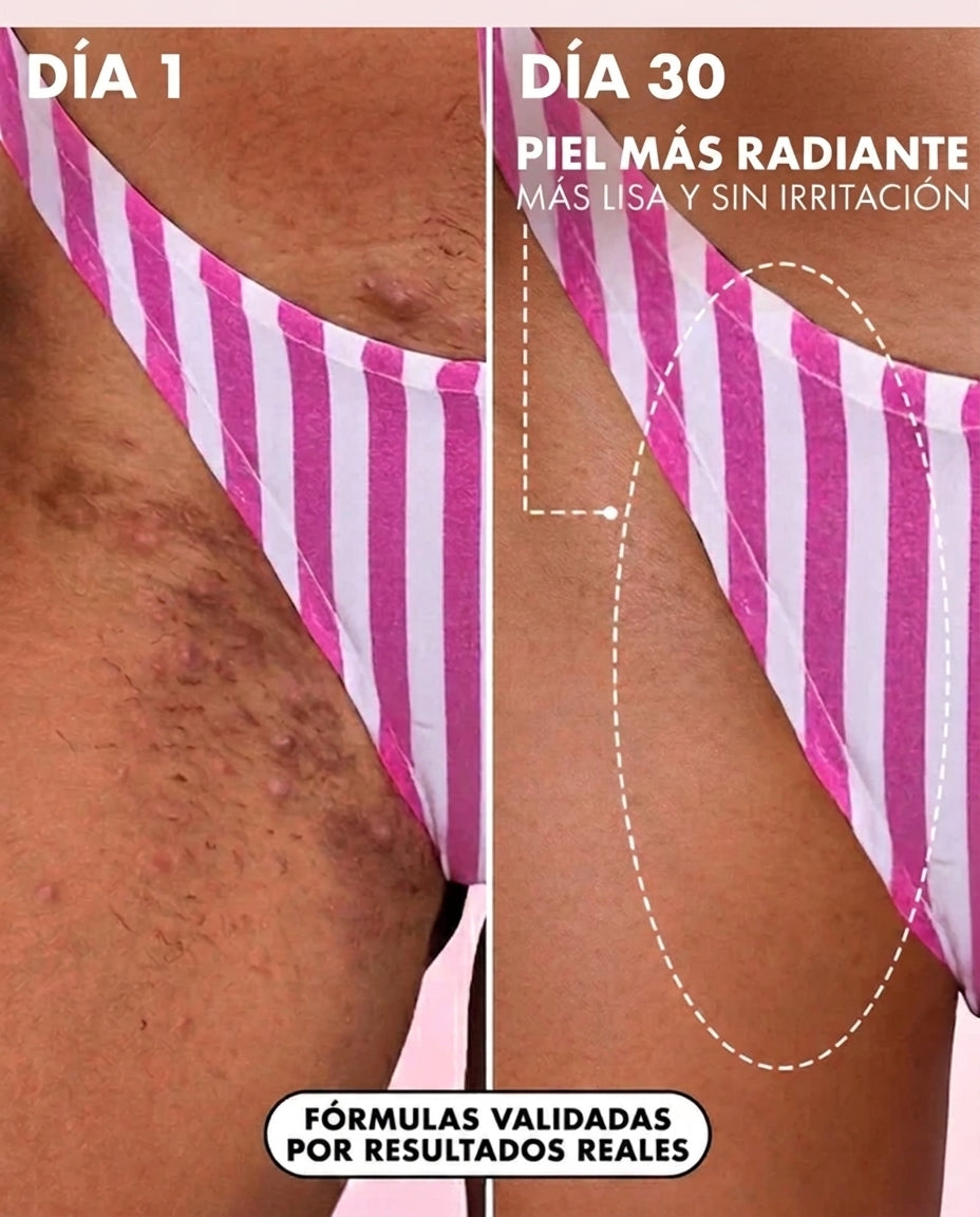 Piel Despigmentada, Tono Uniforme En Semanas 1+1 Gratis ¡SOLO HOY!